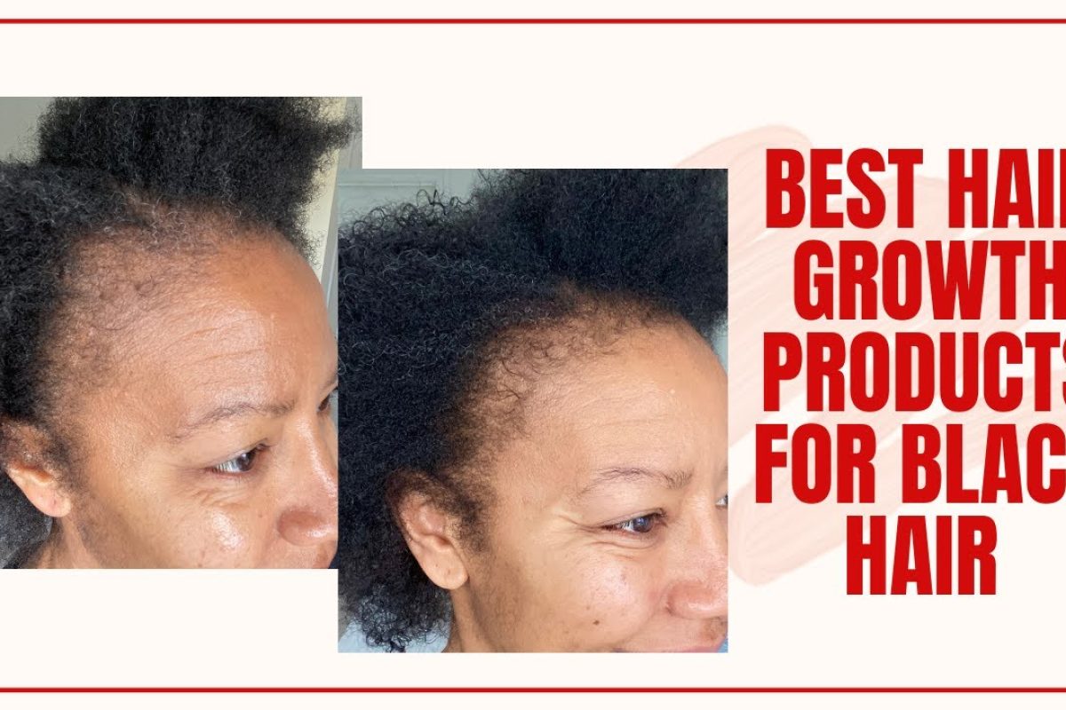 Best Hair Growth Serum for Black Hair