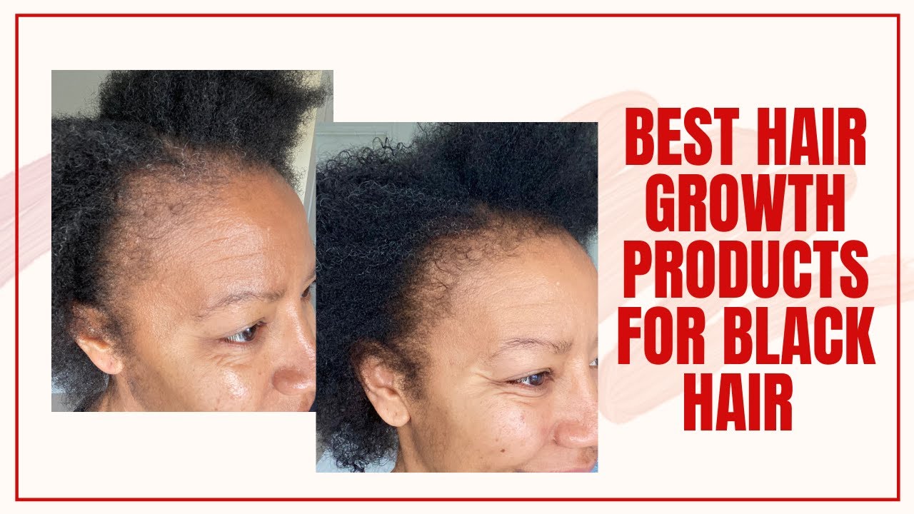 Best Hair Growth Serum for Black Hair: Top Picks!