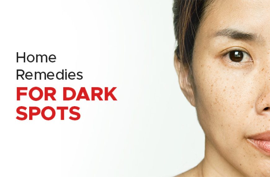 How to Treat Dark Spots